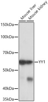 YY1 Rabbit mAb