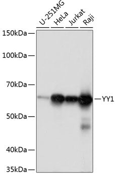 YY1 Rabbit mAb