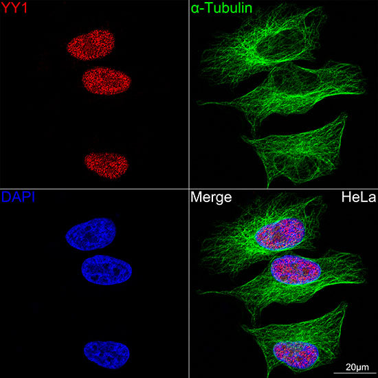 YY1 Rabbit mAb