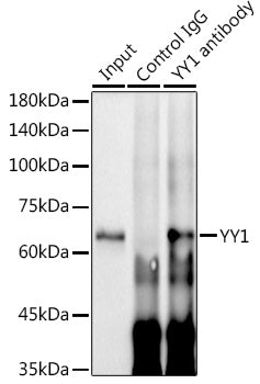 YY1 Rabbit mAb