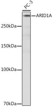 ARID1A Rabbit mAb