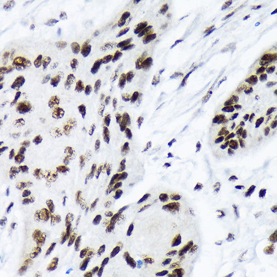 ARID1A Rabbit mAb