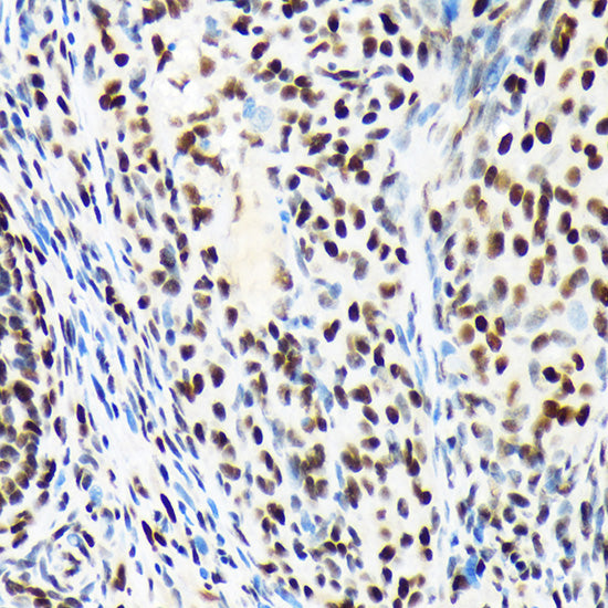 ARID1A Rabbit mAb