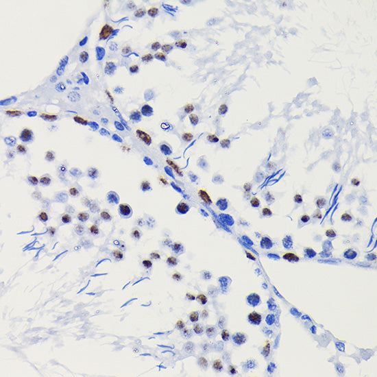 HDAC1 Rabbit mAb