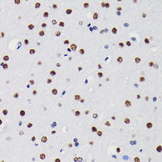 HDAC1 Rabbit mAb