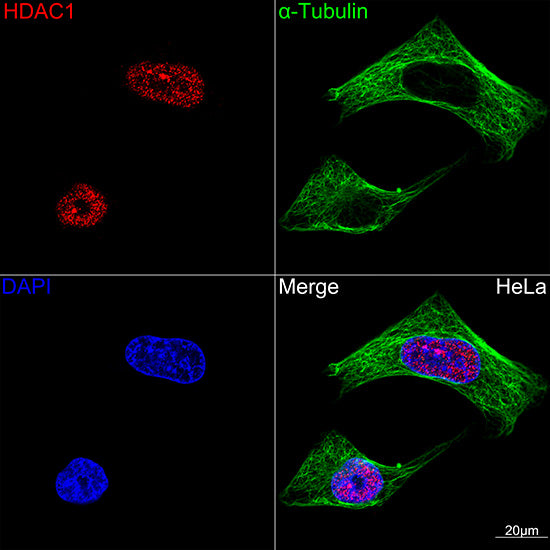 HDAC1 Rabbit mAb
