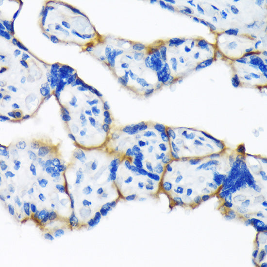 Dysferlin Rabbit mAb