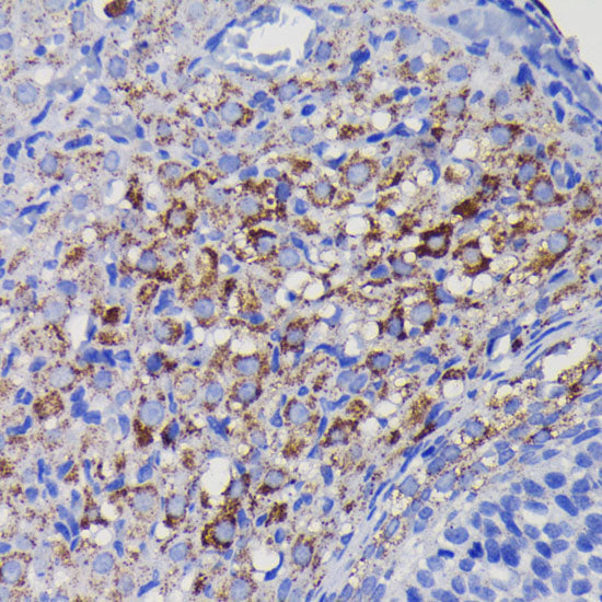 [KO Validated] SOD2 Rabbit mAb