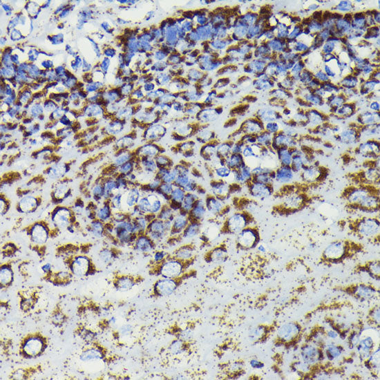 [KO Validated] SOD2 Rabbit mAb