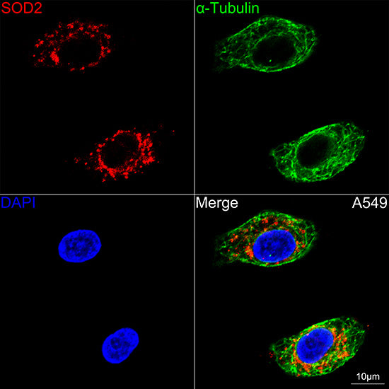 [KO Validated] SOD2 Rabbit mAb
