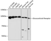 Glucocorticoid Receptor Rabbit mAb