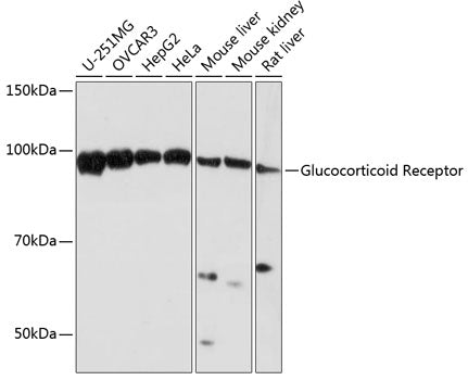 Glucocorticoid Receptor Rabbit mAb
