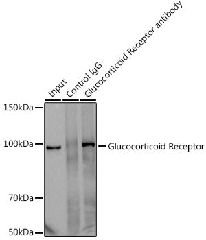 Glucocorticoid Receptor Rabbit mAb
