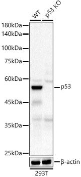 [KO Validated] p53 Rabbit mAb