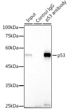 [KO Validated] p53 Rabbit mAb
