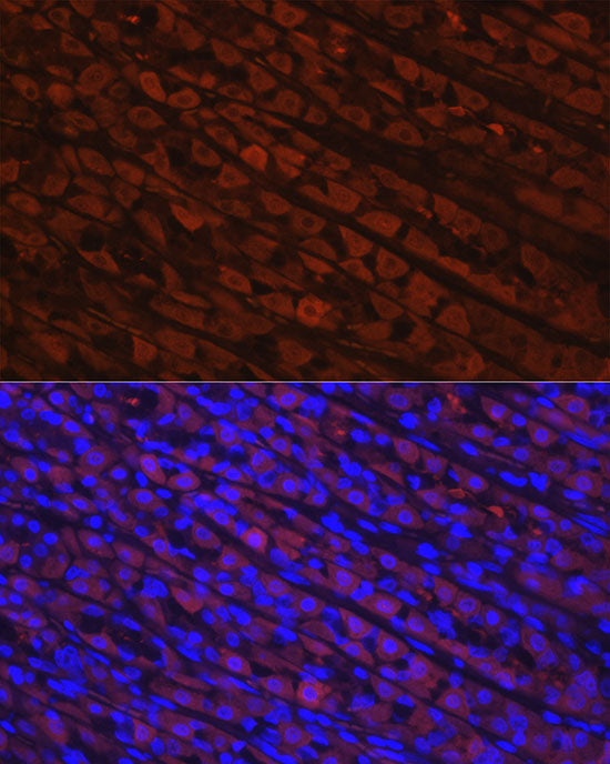 [KO Validated] NQO1 Rabbit mAb