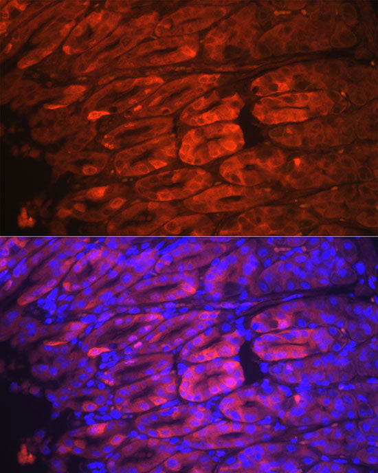 [KO Validated] NQO1 Rabbit mAb