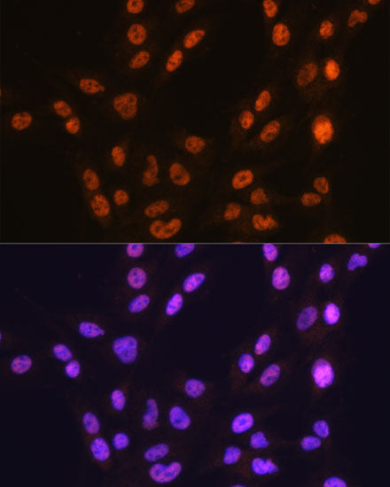 CTCF Rabbit mAb