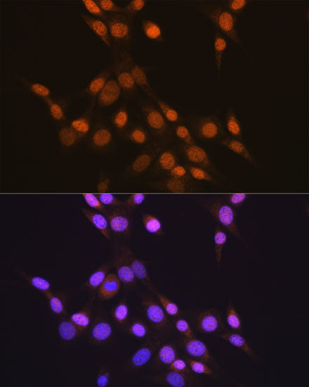 CTCF Rabbit mAb