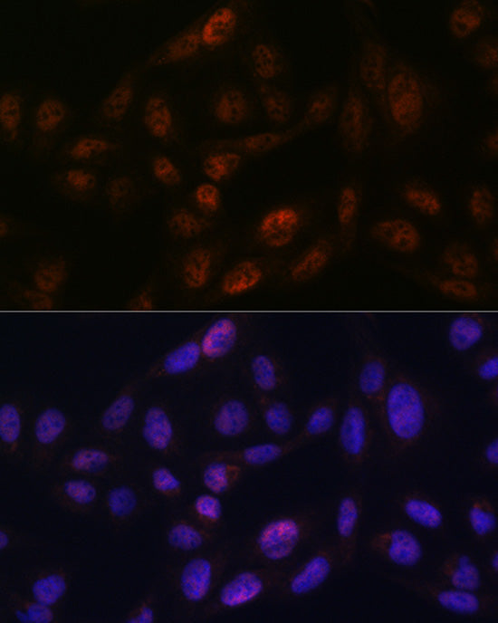 SMC3 Rabbit mAb