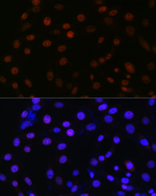SMC3 Rabbit mAb