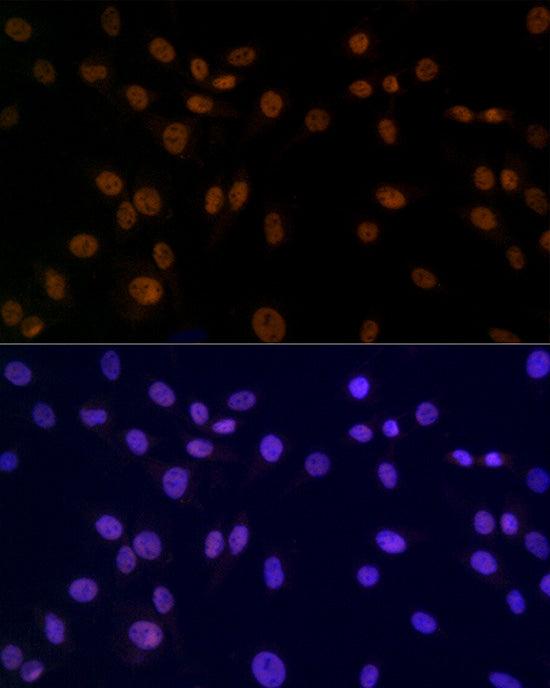 SMC3 Rabbit mAb