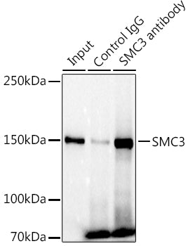 SMC3 Rabbit mAb