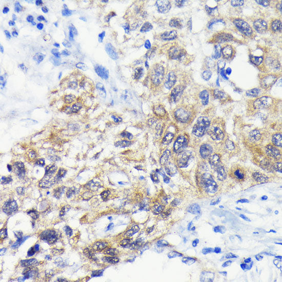 ATG3 Rabbit mAb
