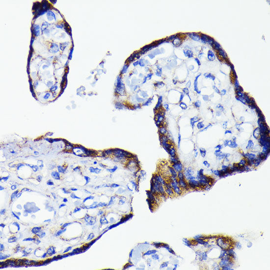 Bad Rabbit mAb