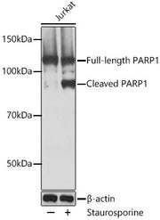 PARP1 Rabbit mAb