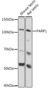 PARP1 Rabbit mAb