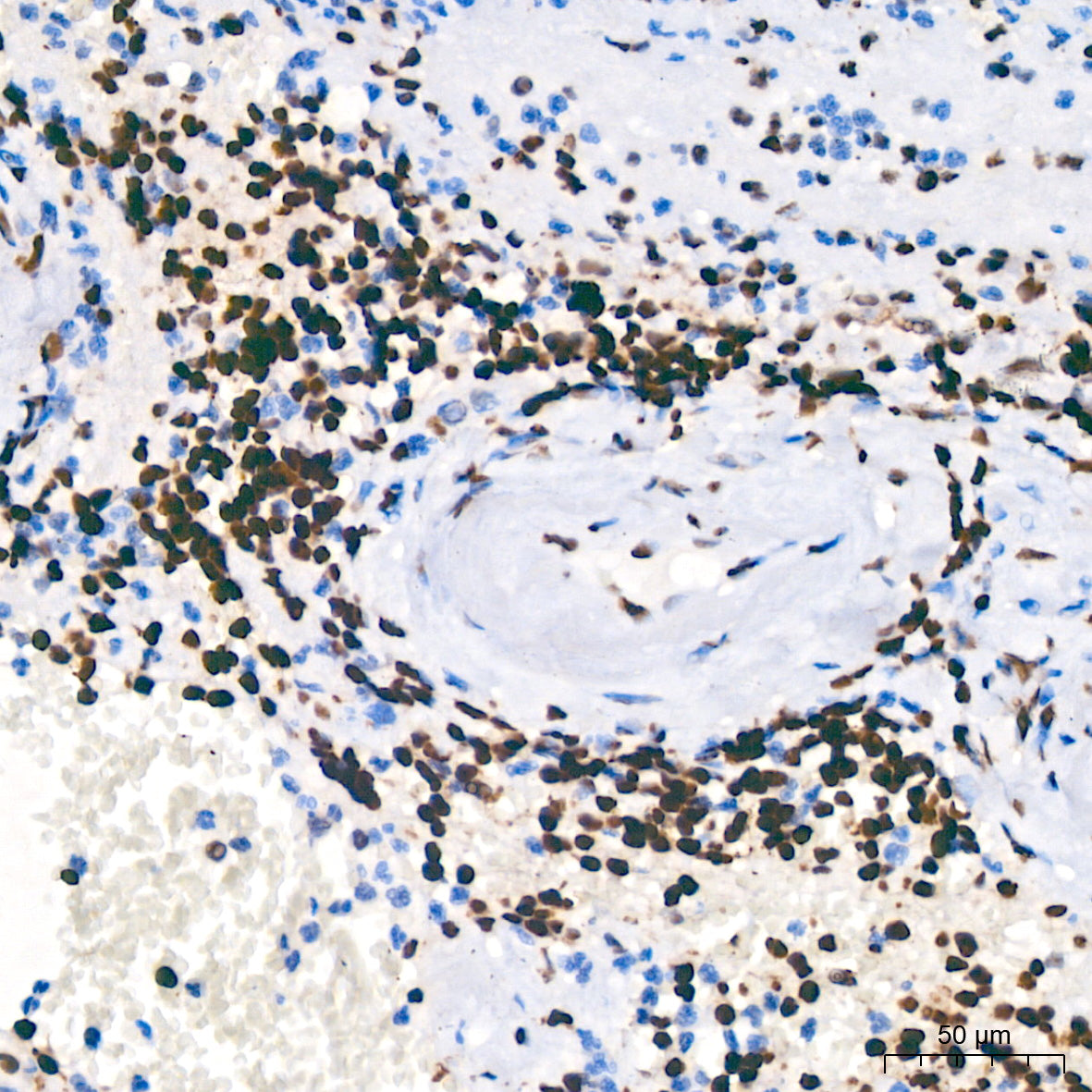 PARP1 Rabbit mAb