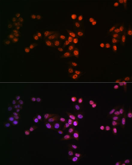 DROSHA Rabbit mAb