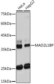MAD2L1BP Rabbit mAb