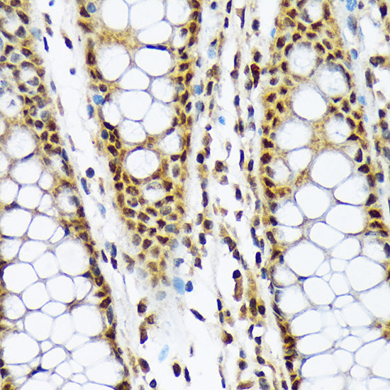 MAD2L1BP Rabbit mAb