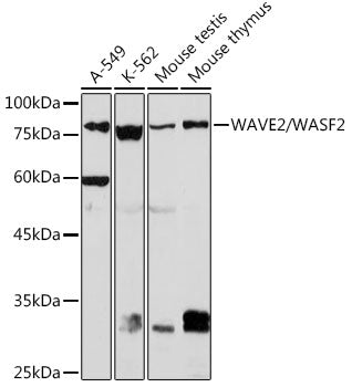 WAVE2/WASF2 Rabbit mAb