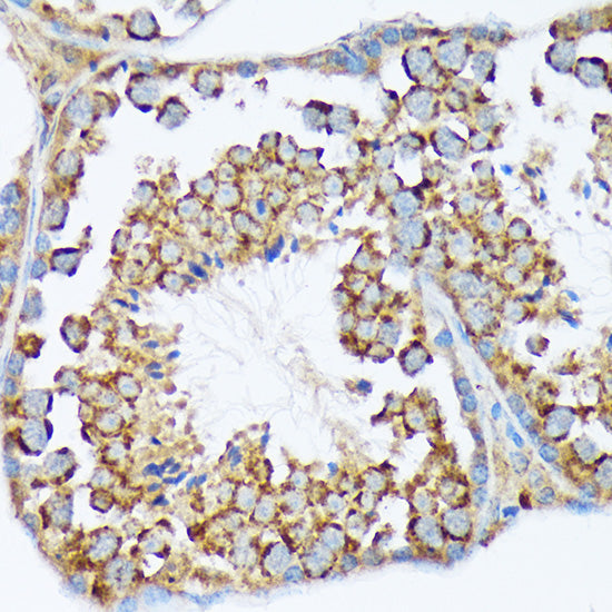WAVE2/WASF2 Rabbit mAb