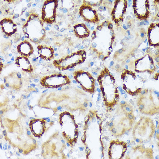 WAVE2/WASF2 Rabbit mAb