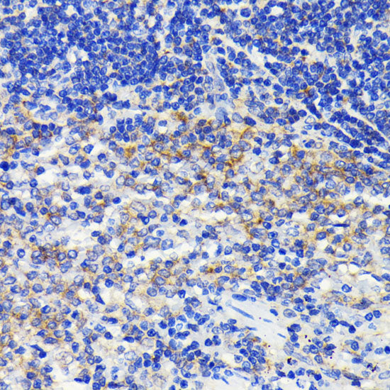 [KD Validated] ATG7 Rabbit mAb