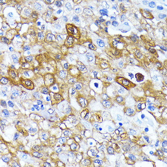 [KD Validated] ATG7 Rabbit mAb