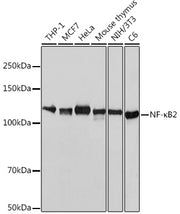 NF-κB2 Rabbit mAb