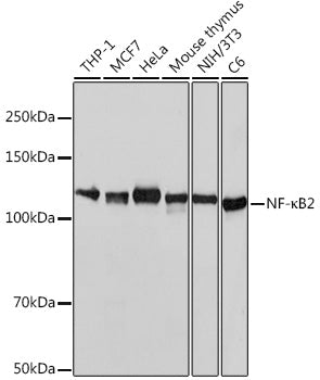 NF-κB2 Rabbit mAb