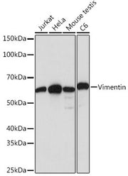 [KD Validated] Vimentin Rabbit mAb