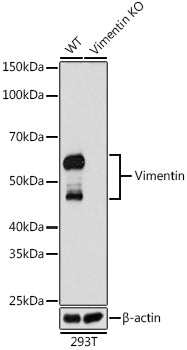 [KD Validated] Vimentin Rabbit mAb