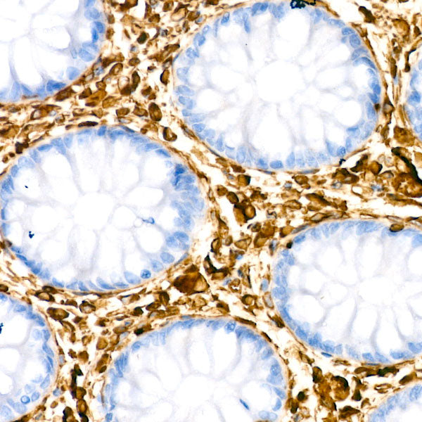 [KD Validated] Vimentin Rabbit mAb