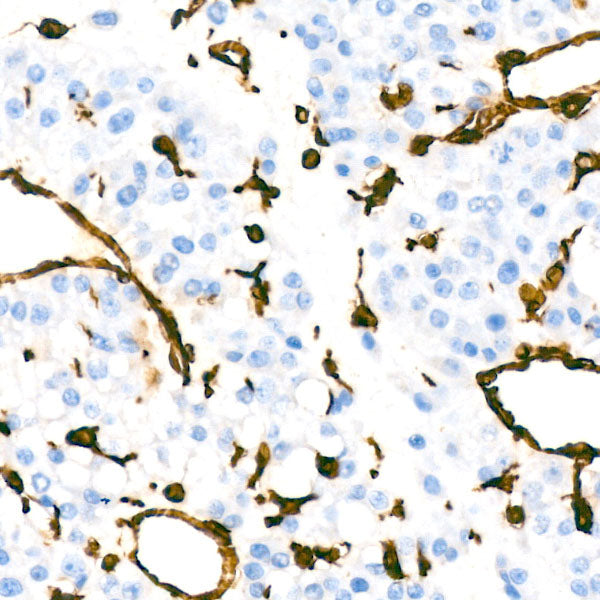 [KD Validated] Vimentin Rabbit mAb