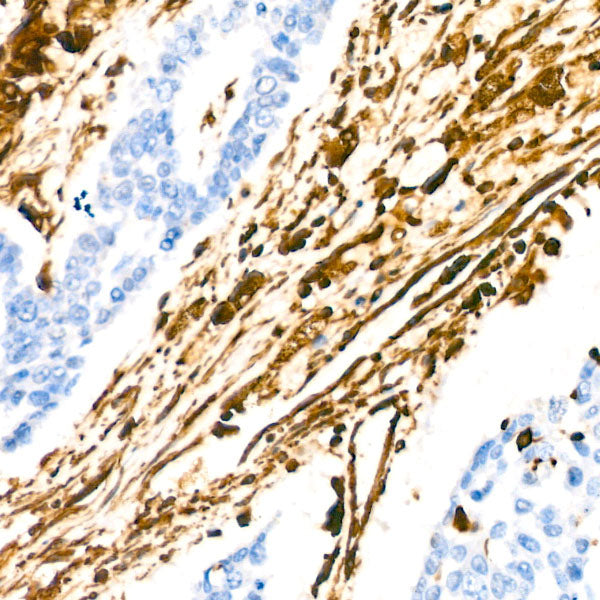 [KD Validated] Vimentin Rabbit mAb