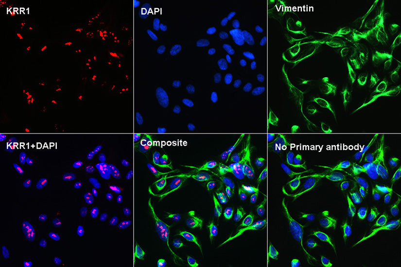 [KD Validated] Vimentin Rabbit mAb