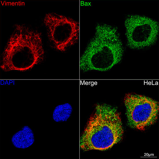 [KD Validated] Vimentin Rabbit mAb