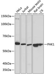 PAK1 Rabbit mAb